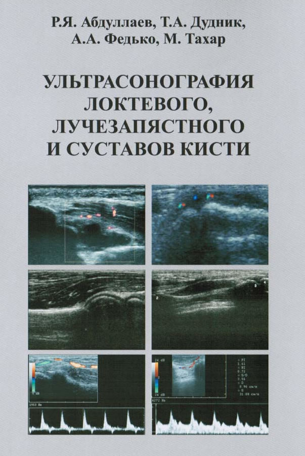 Р.Я. Абдуллаев, Т.А. Дудник, А.А. Федько, М. Тахар «УЛЬТРАСОНОГРАФИЯ ЛОКТЕВОГО, ЛУЧЕЗАПЯСТНОГО И СУСТАВОВ КИСТИ» Р.Я. Абдуллаев, Т.А. Дудник, А.А. Федько, М. Тахар «УЛЬТРАСОНОГРАФИЯ ЛОКТЕВОГО, ЛУЧЕЗАПЯСТНОГО И СУСТАВОВ КИСТИ»
