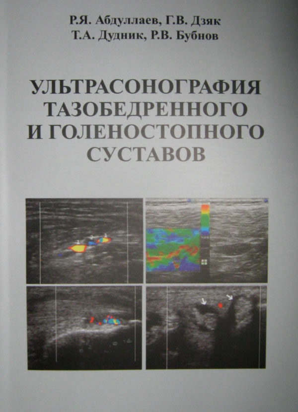 Р.Я. Абдуллаев, Г.В. Дзяк, Т.А. Дудник, Р.В. Бубнов «УЛЬТРАСОНОГРАФИЯ
ТАЗОБЕДРЕННОГО И ГОЛЕНОСТОПНОГО СУСТАВОВ» Р.Я. Абдуллаев, Г.В. Дзяк, Т.А. Дудник, Р.В. Бубнов «УЛЬТРАСОНОГРАФИЯ
ТАЗОБЕДРЕННОГО И ГОЛЕНОСТОПНОГО СУСТАВОВ»