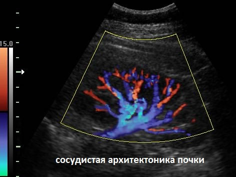 УЗИ в Полтаве - сосудистая архитектоника почки