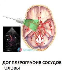 УЗИ в Полтаве - допплерография сосудов головы