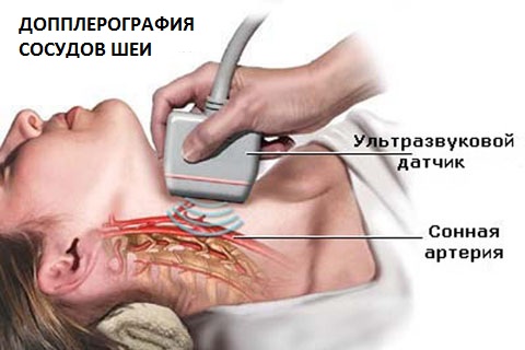 УЗИ в Полтаве - допплерография сосудов шеи