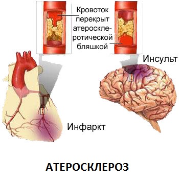 УЗД у Полтаві - ультразвукове дослідження судин головного мозку та серця